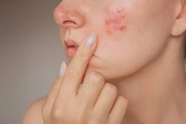 istockphoto-1703880459-612x612
